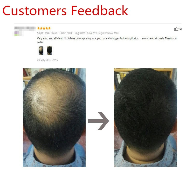 25g Hair Fibers Keratin Thickening Spray Hair Fiber Refill Hair Building Fibers Instant Regrowth Powders Hair Growth Product - AliExpress 66