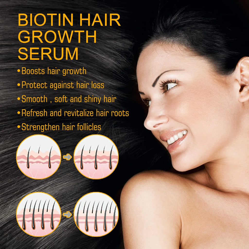 EELHOE Biotin Hair Spray For Man Women 30ml Hair Growth Repair Damage Restore Oil Scalp Repair Serum Spray Thicken Hair Care - AliExpress 66