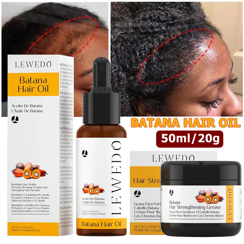 Hair Growth Oil Kit Organic Batana Oil for Hair Growth 100% Pure Hair Strengthening Oil Anti Hair Loss Essence Oil Hair Care