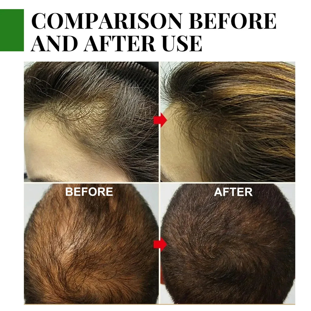 Rosemary Essential Oil Hair Growth Oils Pure Natural 30ML Hair Essential Oils For Nourish Shiny Hair Healthy - AliExpress 66