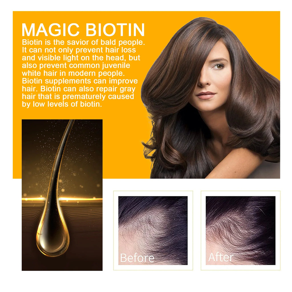 EELHOE Biotin Hair Spray For Man Women 30ml Hair Growth Repair Damage Restore Oil Scalp Repair Serum Spray Thicken Hair Care - AliExpress 66