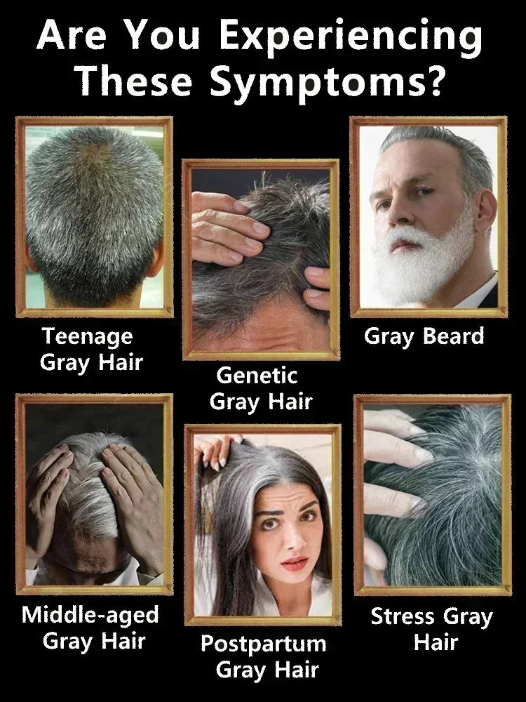 24 NEW White To Black Gray White Hair Serum Natural Color Repair Nourish Essence Anti-gray Care for Men Women - AliExpress 66
