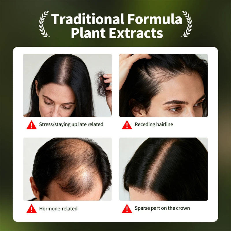 Anti Hair Loss Serum Set Hair Growth Essential Oil Usman Hair Regrowth Shampoo Soap Hair Care Thickening Oil Spray For Men Women - AliExpress 66