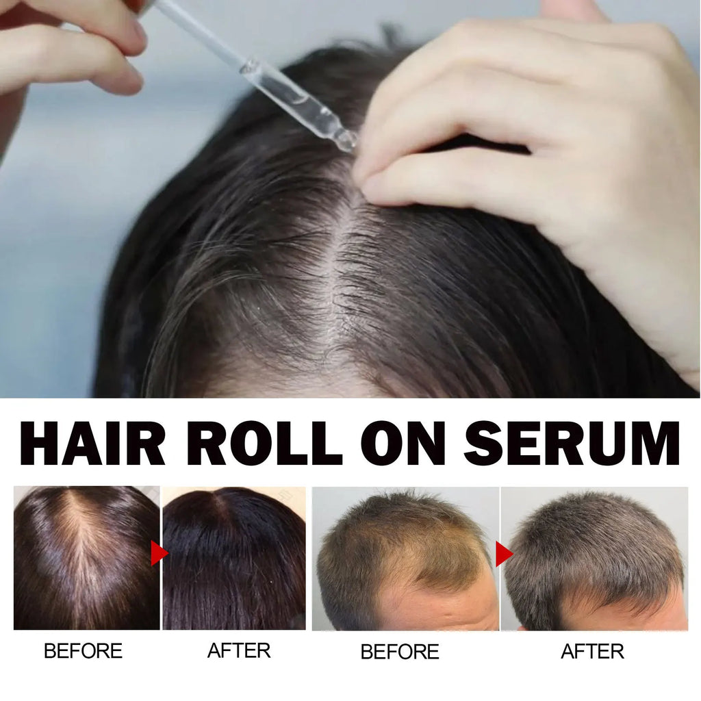 Eelhoe Jojoba Oil Hair Growth Serum Reduce Loss Scalp Treatment More Thicker Keep Regrowth Oil Control Hair Nourish Essencial Oi - AliExpress 66