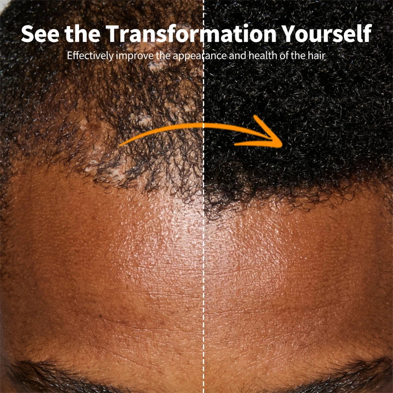 Africa Chad Chebe Powder Nourishing Scalp Anti Hair Loss Hair Powder Strengthens & Thickens Hair Care Product For All Hair Types - AliExpress 66