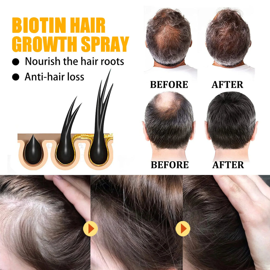 Biotin Hair Care Spray Nourish Scalp Hair Follicle Reduce Hair Loss Stabiliz Hair Root Refresh Oil Control Natural Plant Essence - AliExpress 66
