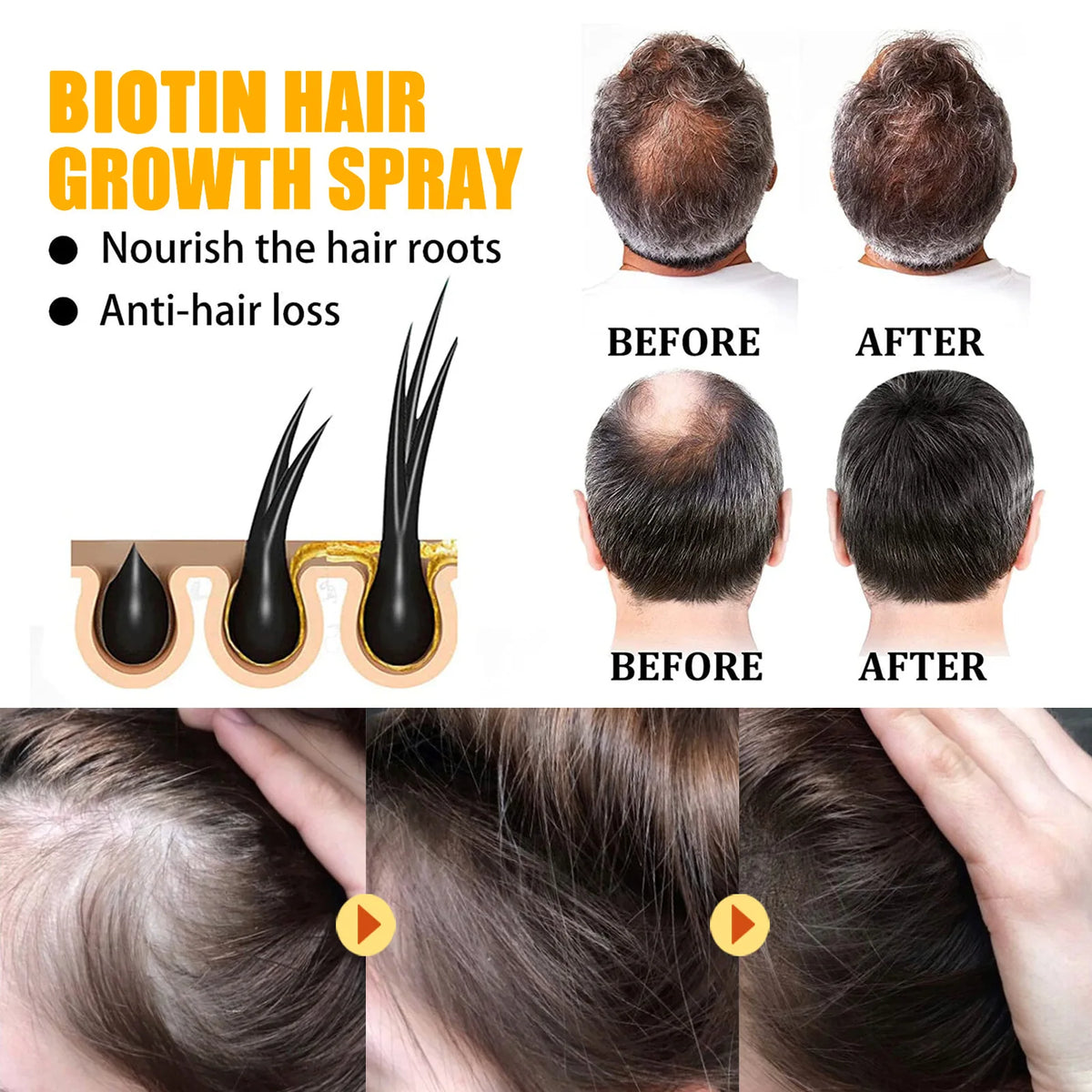 Biotin Hair Care Spray Nourish Scalp Hair Follicle Reduce Hair Loss Stabiliz Hair Root Refresh Oil Control Natural Plant Essence - AliExpress 66