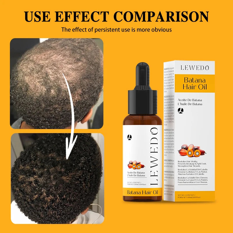 Hair Growth Oil Kit Organic Batana Oil for Hair Growth 100% Pure Hair Strengthening Oil Anti Hair Loss Essence Oil Hair Care