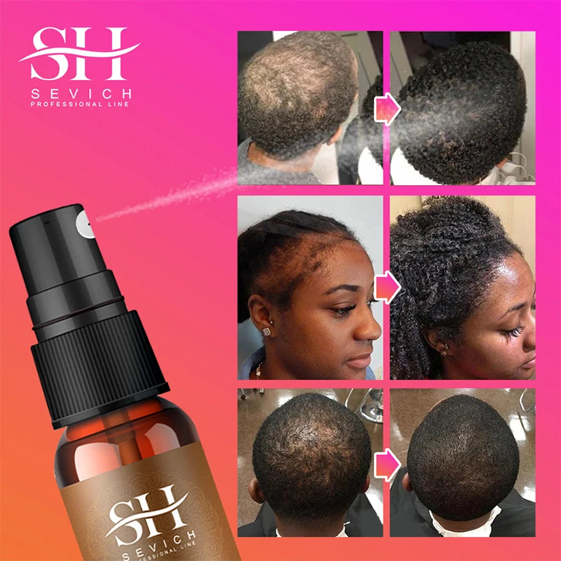 10ml Chebe Spray Fast Hair Growth Oil Hair Loss Treatment Traction Alopecia Spray Repair Damage Anti Hair Break Hair Care Spray - AliExpress 66