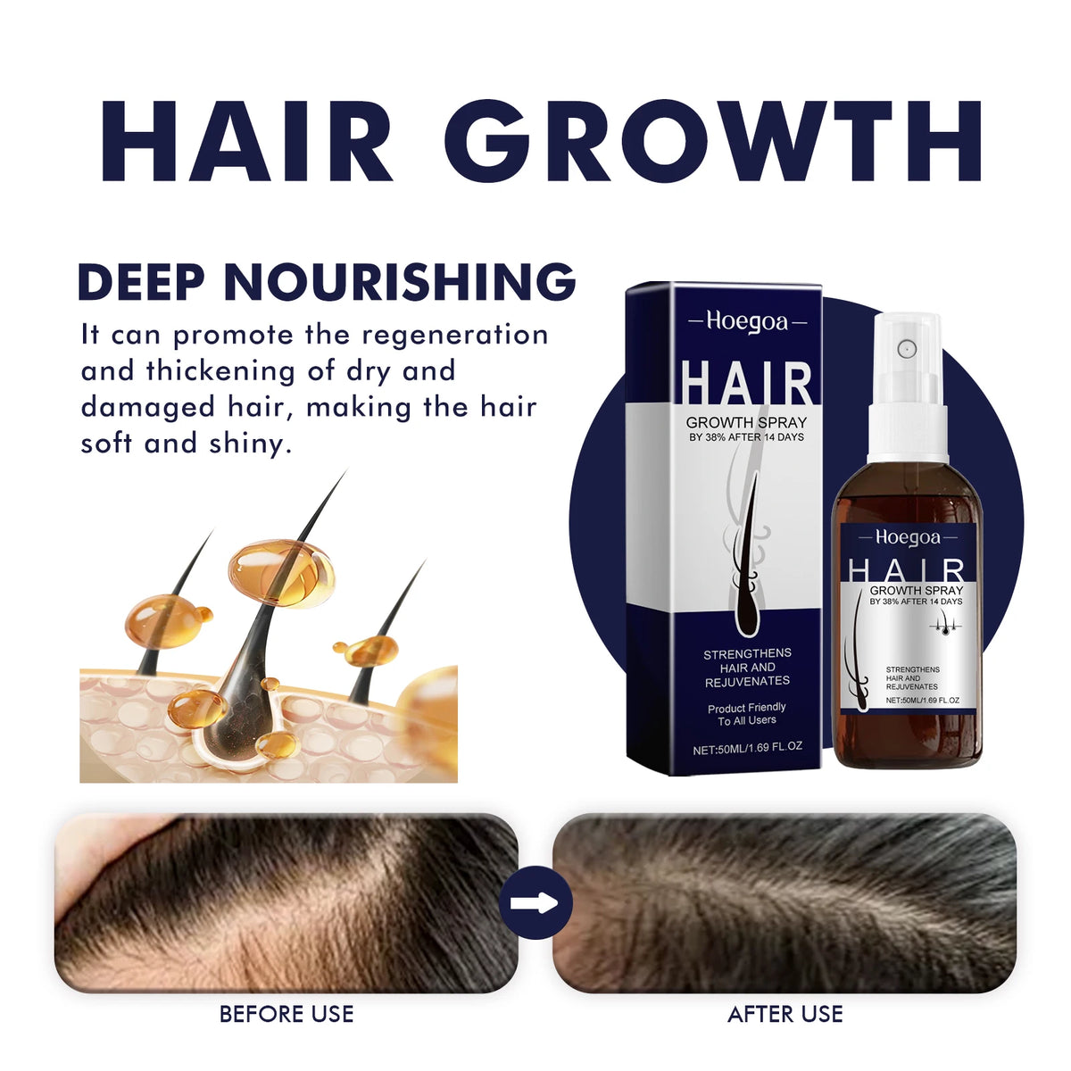 Hair Growth Spray Prevent Baldness Treatment Scalp Dry Damaged Split Hair Dense Strengthen Nourishing Smoothing Massage Liquid - AliExpress 66