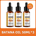 Lewedo Naturals Batana Oil Fast Hair Growth for Men Women Pure Batana Oil Nourish Shiny Hair Healthy Hair Care Anti Hair Loss - AliExpress 66