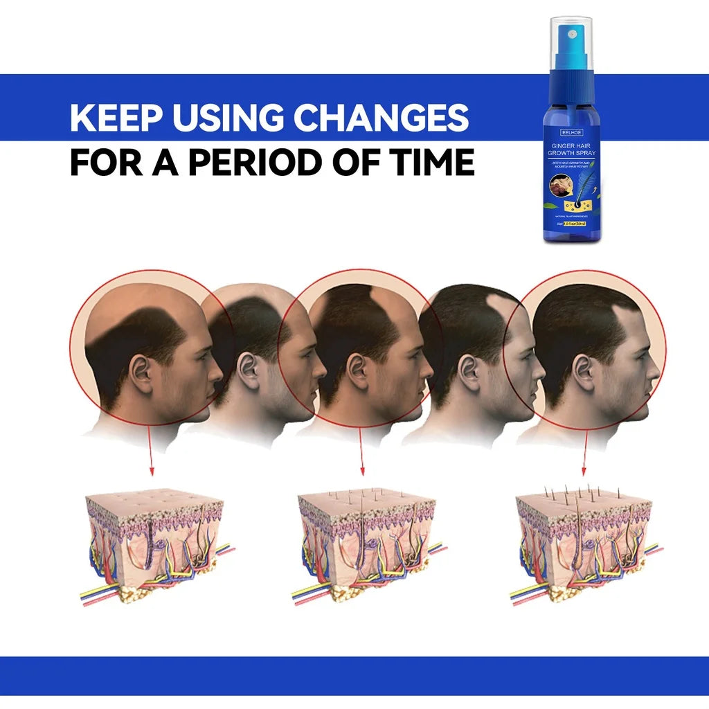 Ginger Hair Growth spray Anti Hair Fall Hair Loss Treatment Hair Growth Essence Oil for Men Women hair treatment - AliExpress 66