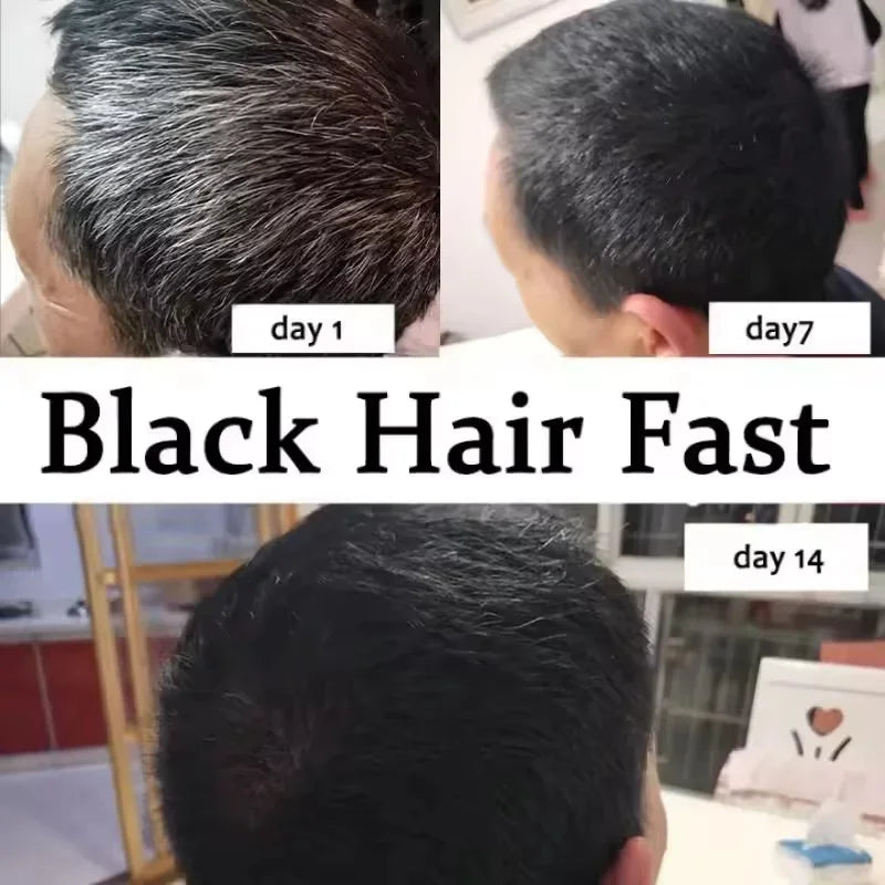 Gray to Black Hair Treatment Serum ¨C Natural Color Restore