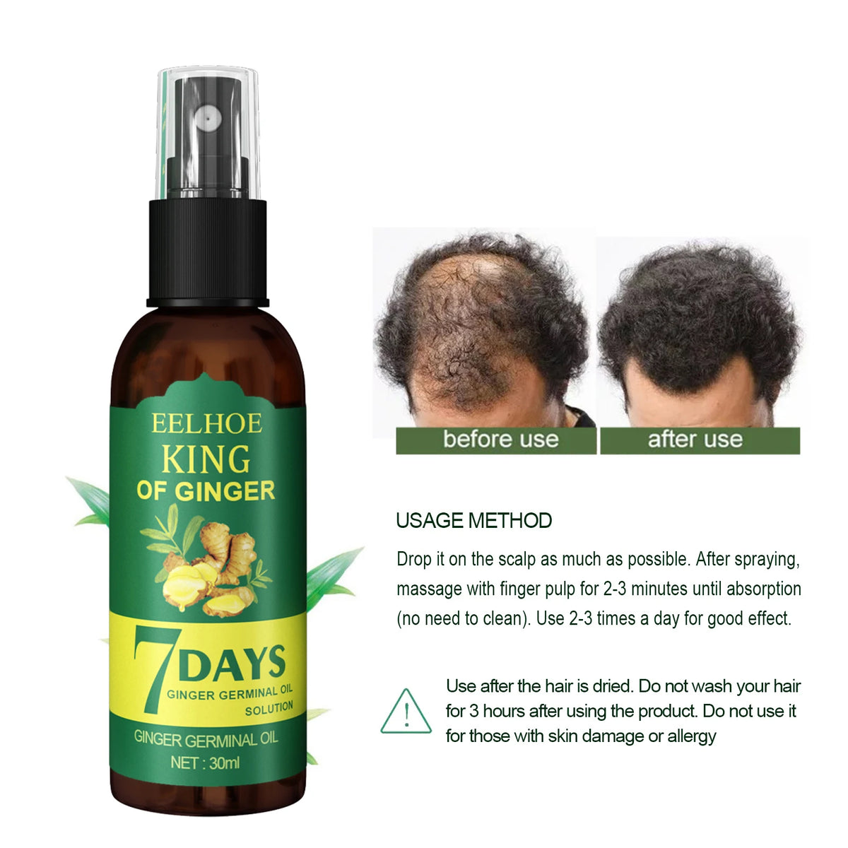 Ginger Care Hair Spray Hair Growth Essence Nourish Hair Roots Massag Scalp Repair Hair Quality Control Oil Hair Care Solution - AliExpress 66