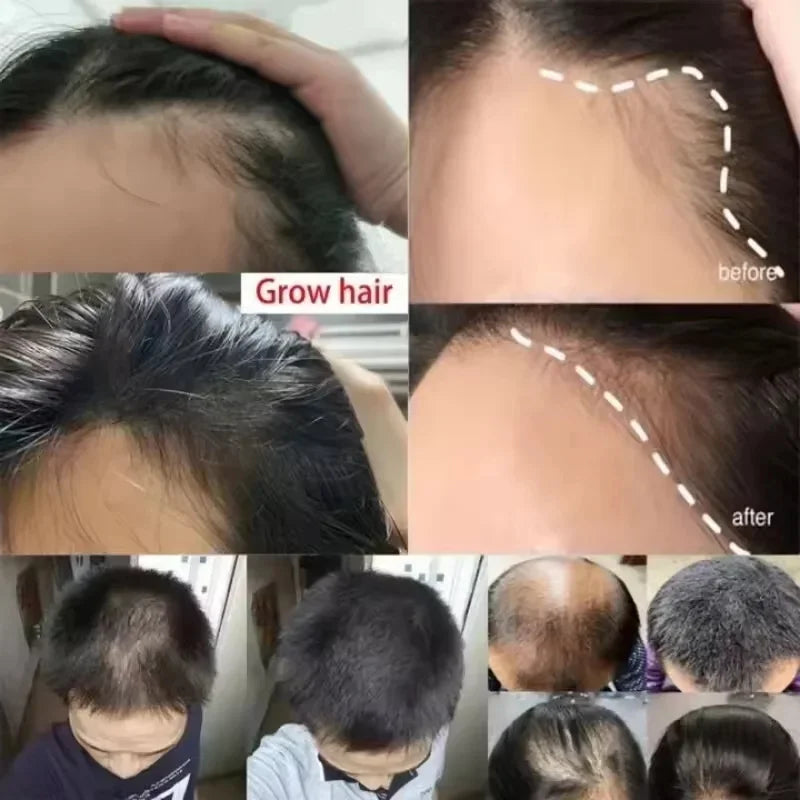 Batana Oil Hair Growth Serum Spray for Hair Regrowth