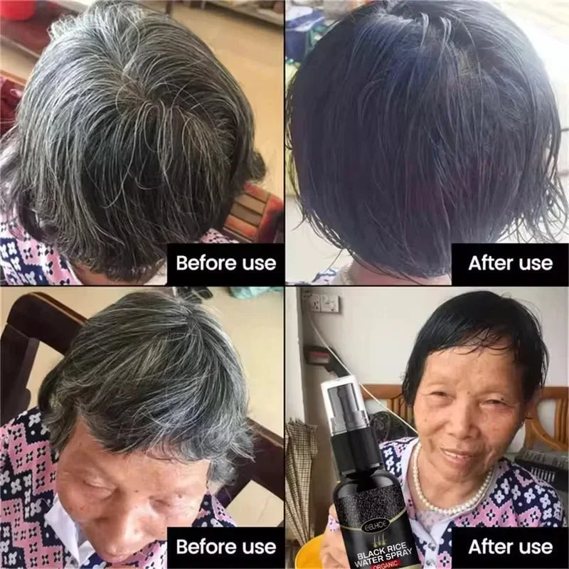 Gray to Black Hair Treatment Serum ¨C Natural Color Restore