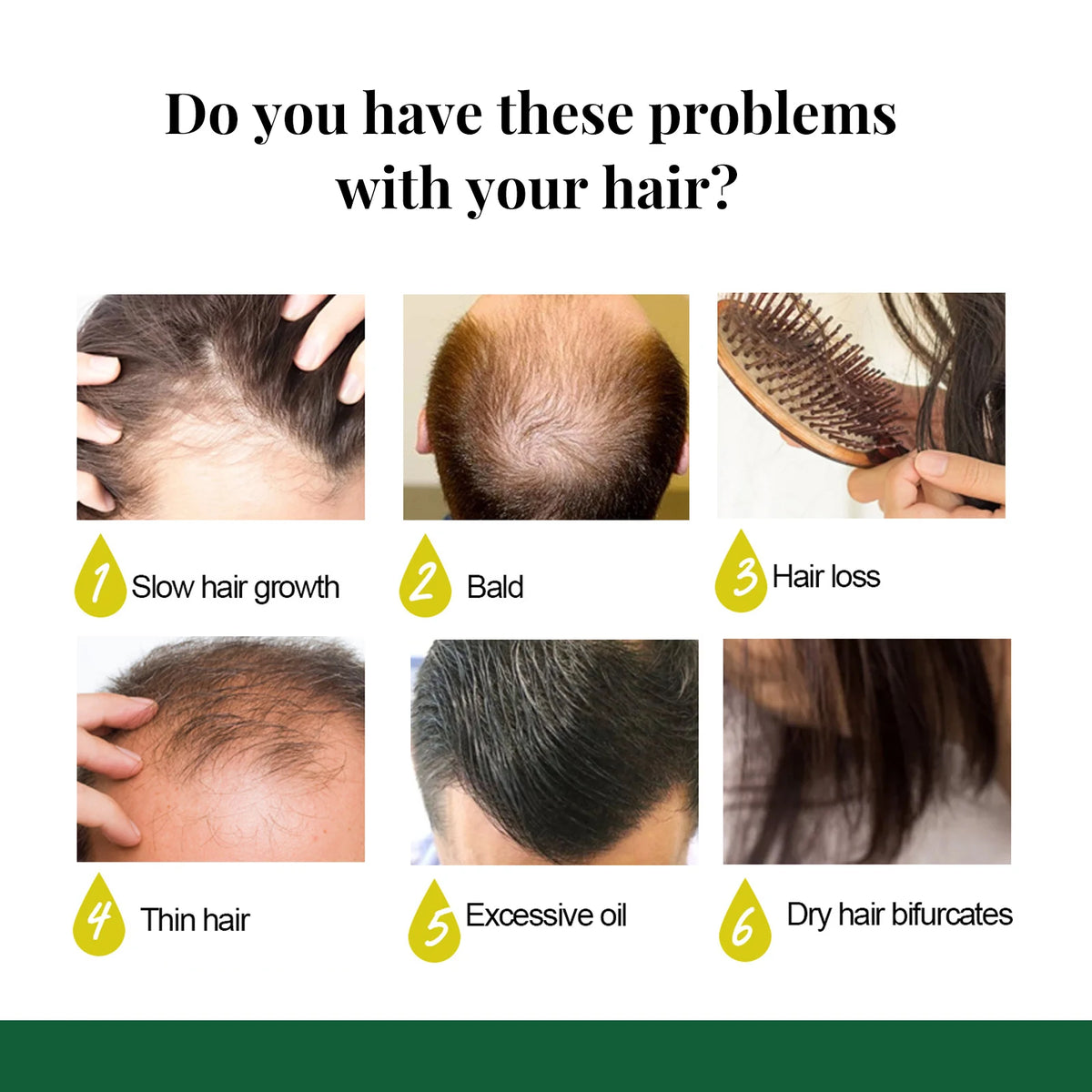 Ginger Care Hair Spray Hair Growth Essence Nourish Hair Roots Massag Scalp Repair Hair Quality Control Oil Hair Care Solution - AliExpress 66