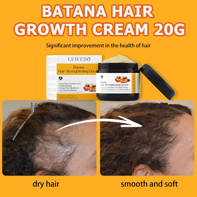 Hair Growth Oil Kit Organic Batana Oil for Hair Growth 100% Pure Hair Strengthening Oil Anti Hair Loss Essence Oil Hair Care