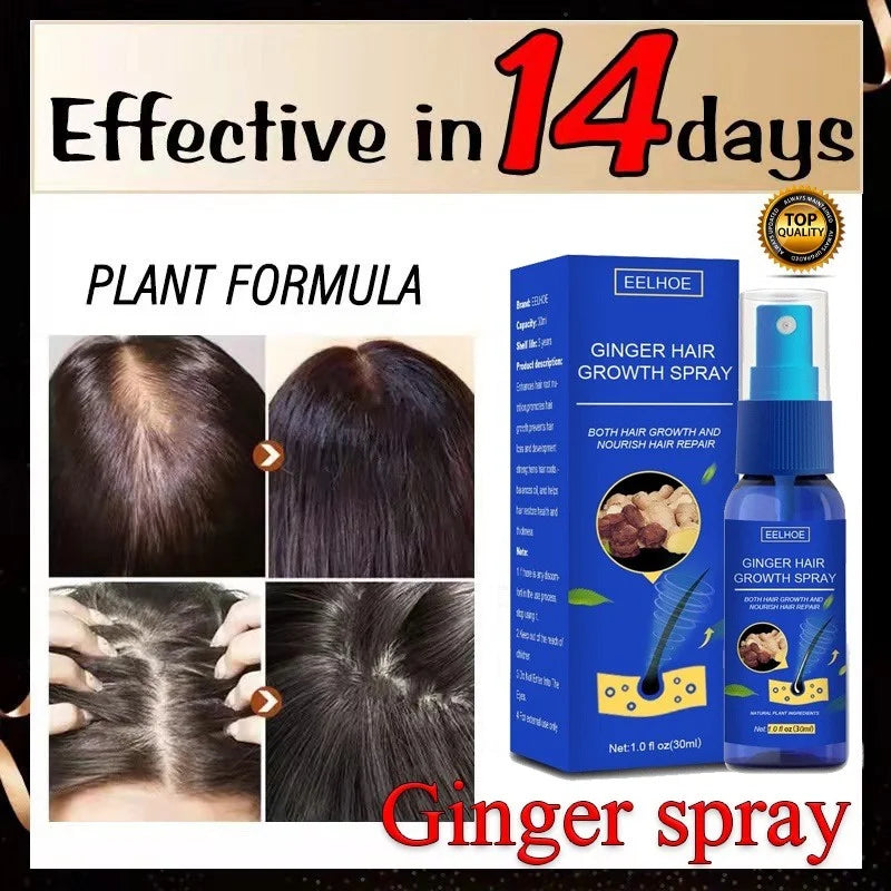 Ginger Hair Growth spray Anti Hair Fall Hair Loss Treatment Hair Growth Essence Oil for Men Women hair treatment - AliExpress 66