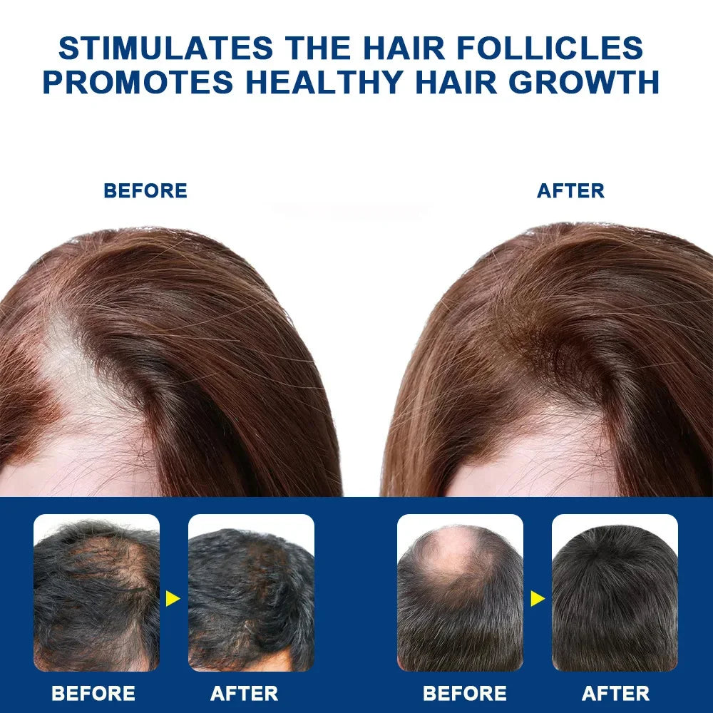 Fast Hair Growth Cream Anti Hair Loss Prevent Baldness Scalp Treatment Repair Roots Beauty Health Hair Care For Men Women