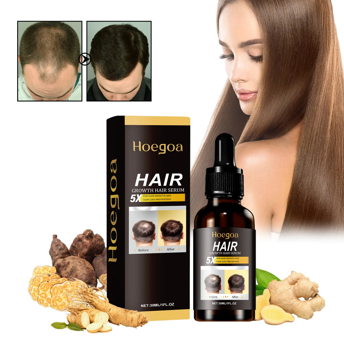 Hair Care Serum Oil Ginger Hair Regrowth Anti-Hair Loss Repairing Nourish Damaged Hair Roots Dense Essence Hair Conditioner - AliExpress 66