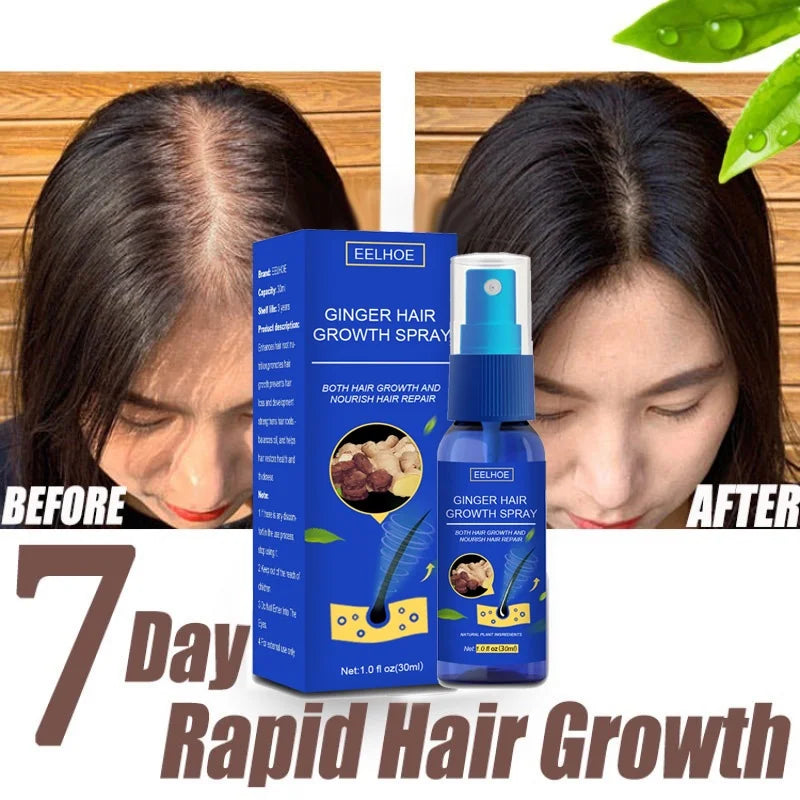 Ginger Hair Growth spray Anti Hair Fall Hair Loss Treatment Hair Growth Essence Oil for Men Women hair treatment - AliExpress 66