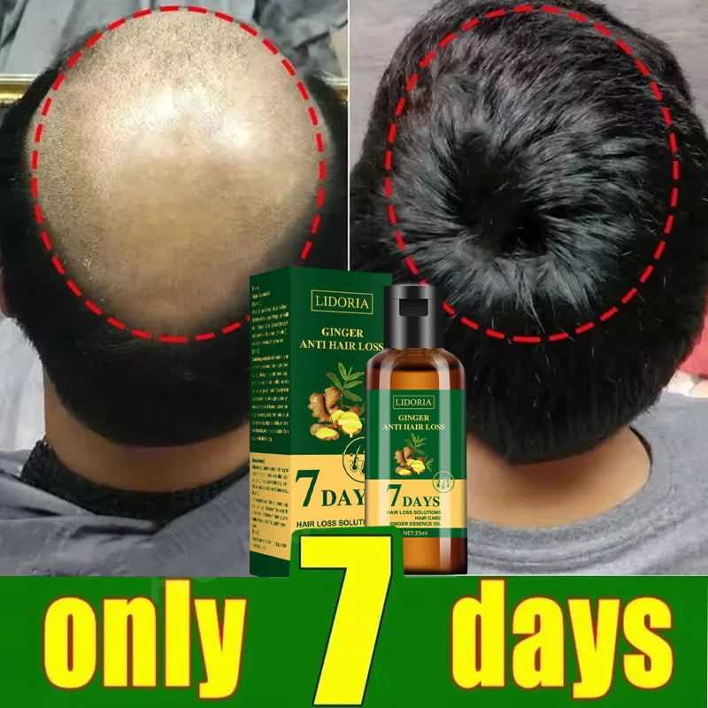 Ginger Hair Growth Serum 35ml for Men & Women