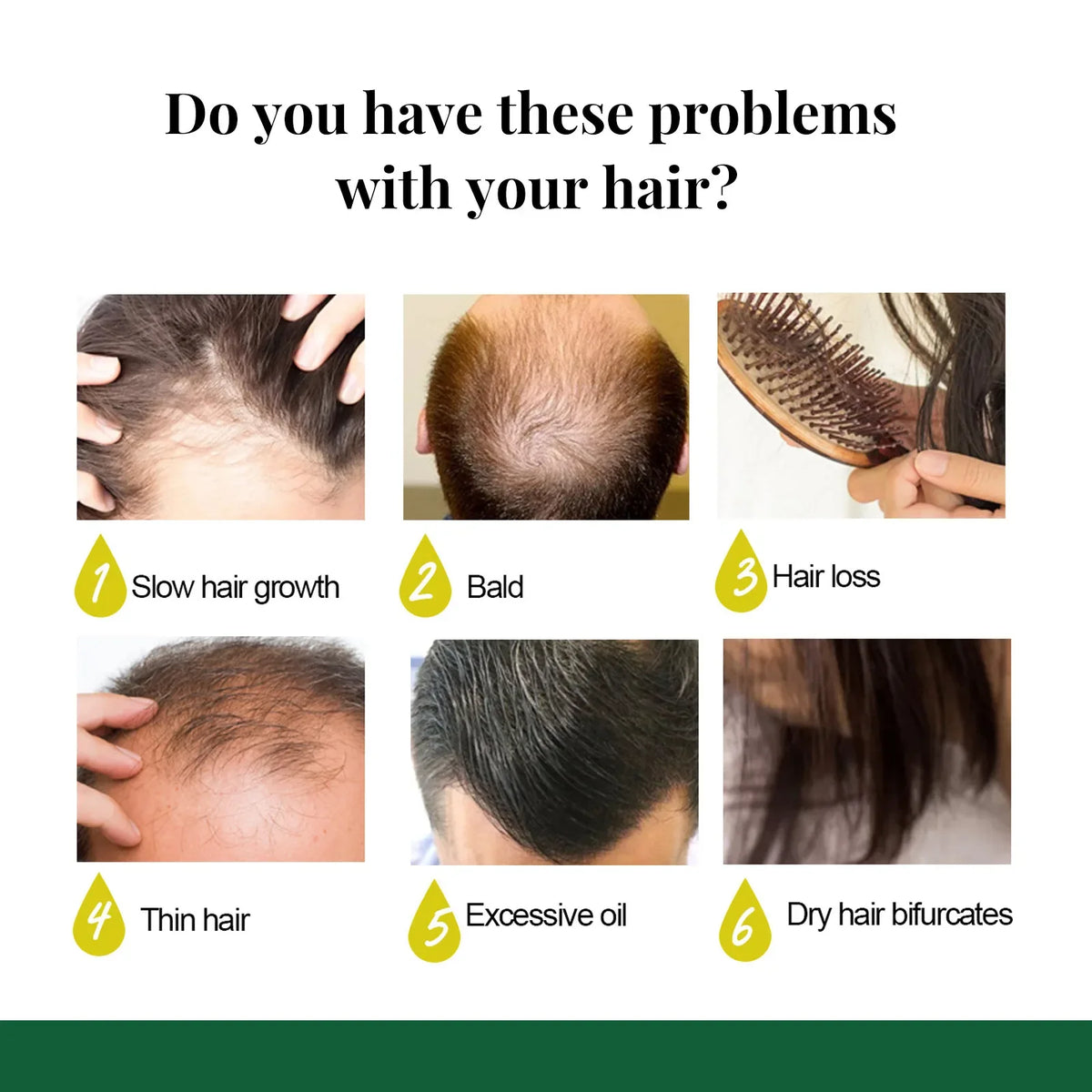 EELHOE Hair Growth Spray 7 Day Ginger Serum Scalp Damaged Treatement Prevent Hair Loss Effective Fast Growth Massage Liquid 50ml