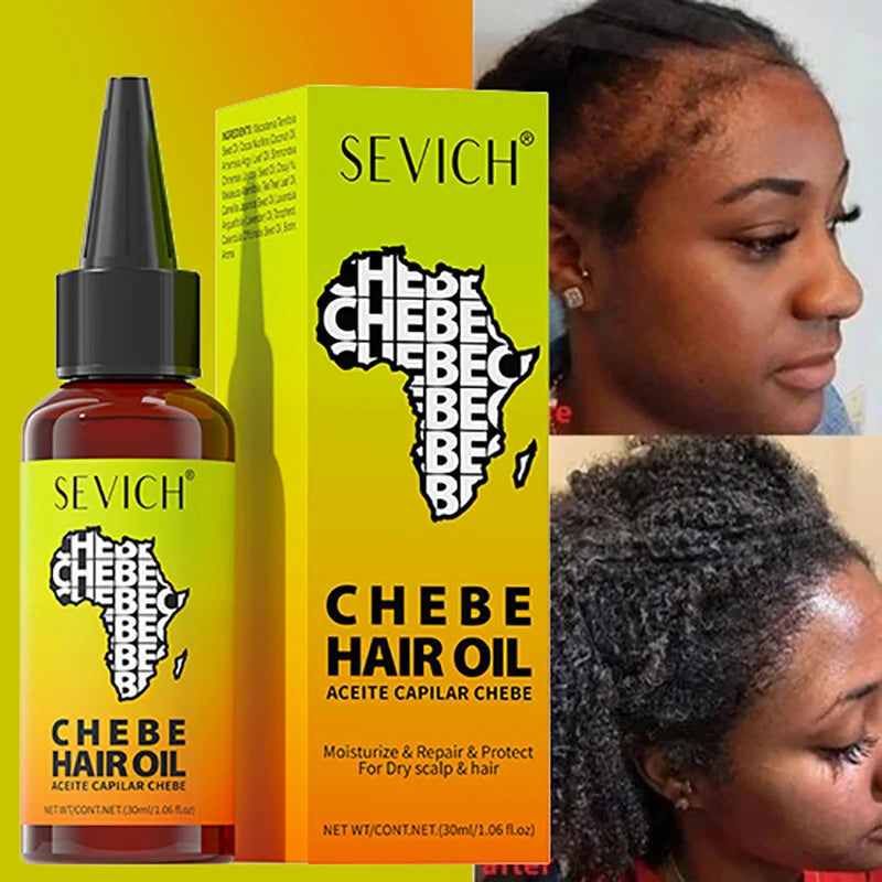 Chebe Fast Hair Growth Oil Hair Regrowth Growth Oil Anti Hair Loss Chebe Hair Mask Repair Damaged Strengthen Anti Hair Break - AliExpress 66