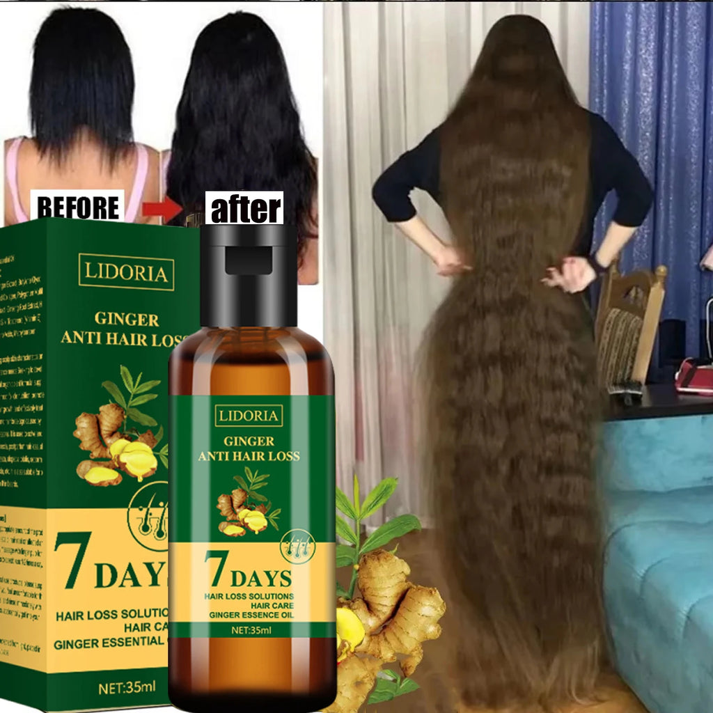 Ginger Hair Growth Serum 35ml for Men & Women