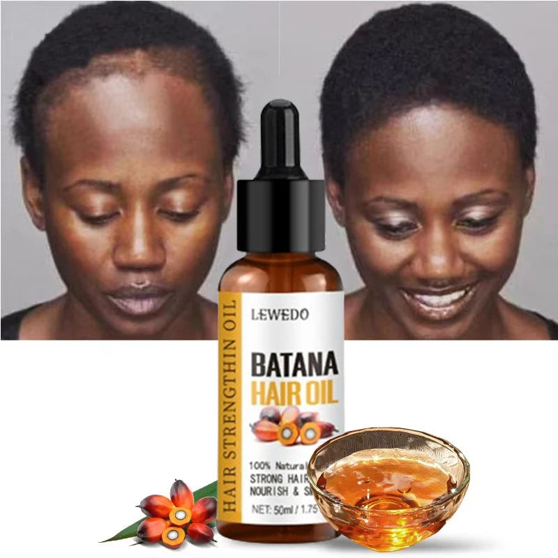 Lewedo Naturals Batana Oil Fast Hair Growth for Men Women Pure Batana Oil Nourish Shiny Hair Healthy Hair Care Anti Hair Loss - AliExpress 66