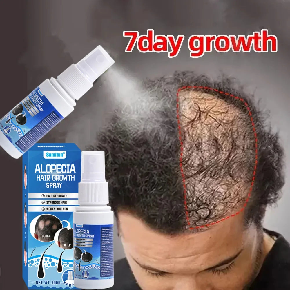Fast Hair Growth Serum Spray Anti Hair Loss Prevent Baldness Scalp Treatment Repair Roots Beauty Health Hair Care For Men Women
