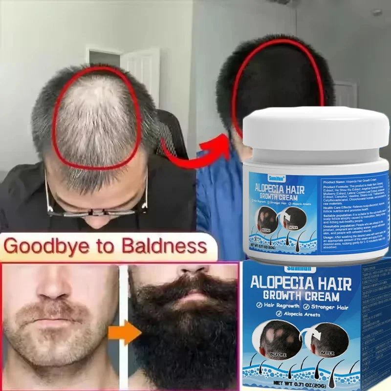 Fast Hair Growth Cream Anti Hair Loss Prevent Baldness Scalp Treatment Repair Roots Beauty Health Hair Care For Men Women