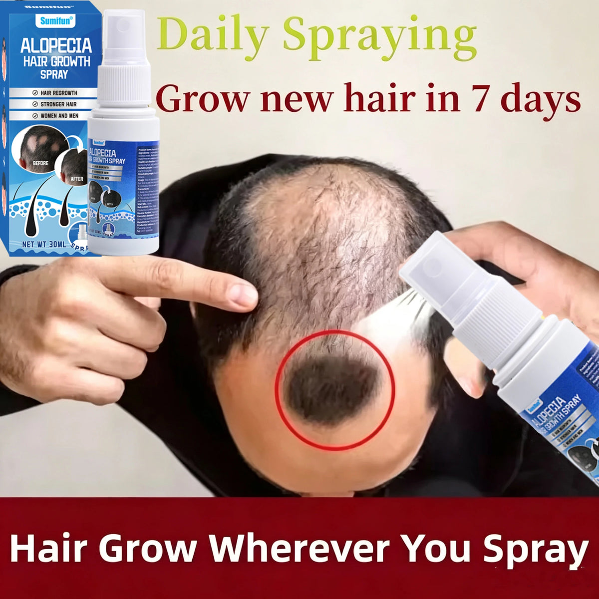 Fast Hair Growth Serum Spray Anti Hair Loss Prevent Baldness Scalp Treatment Repair Roots Beauty Health Hair Care For Men Women
