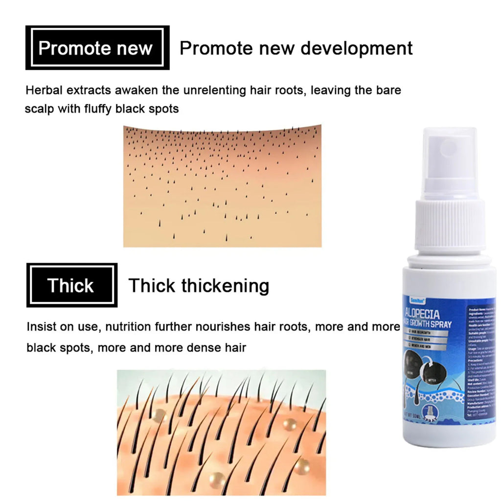 Fast Hair Growth Serum Spray Anti Hair Loss Prevent Baldness Scalp Treatment Repair Roots Beauty Health Hair Care For Men Women