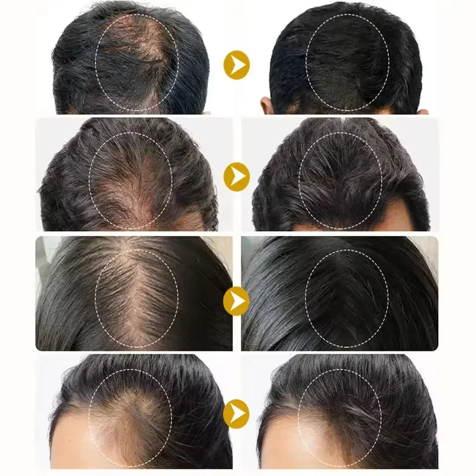 Batana Oil Hair Growth Serum Spray for Hair Regrowth