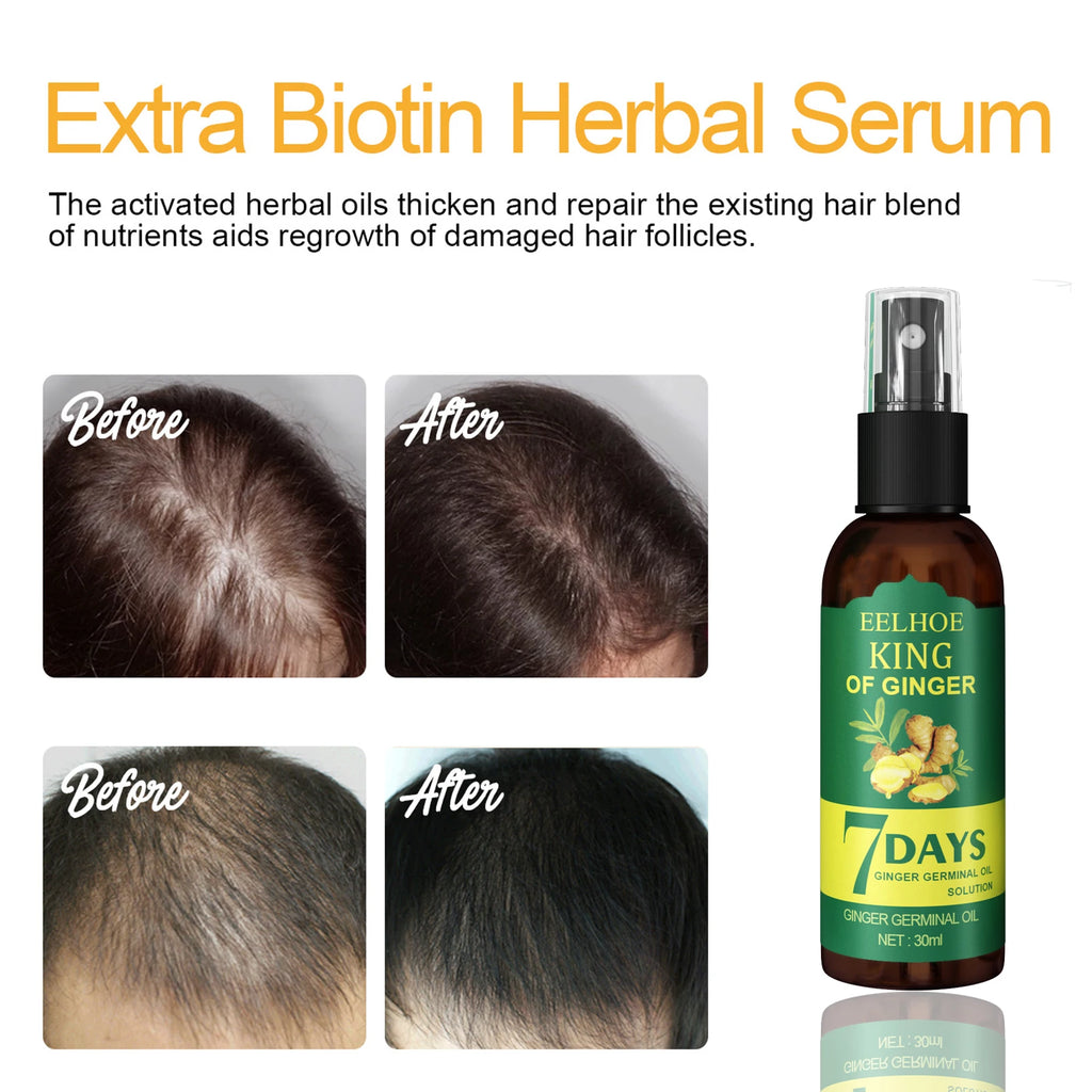 Ginger Care Hair Spray Hair Growth Essence Nourish Hair Roots Massag Scalp Repair Hair Quality Control Oil Hair Care Solution - AliExpress 66