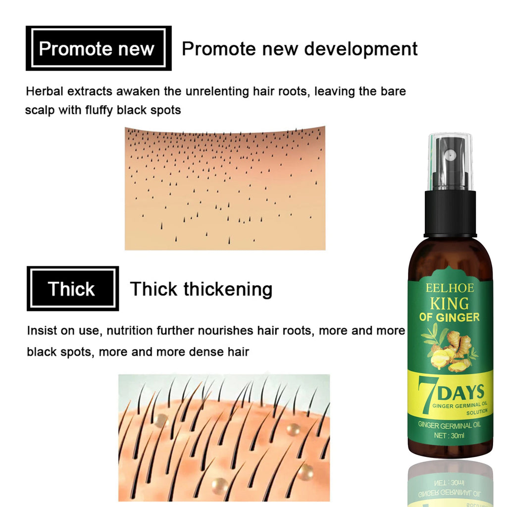 Ginger Oil Hair Booster Serum Spray Nourish Scalp Hair Follicles Refresh Control Oil Strengthen Hair Roots Nutrient Solution - AliExpress 66