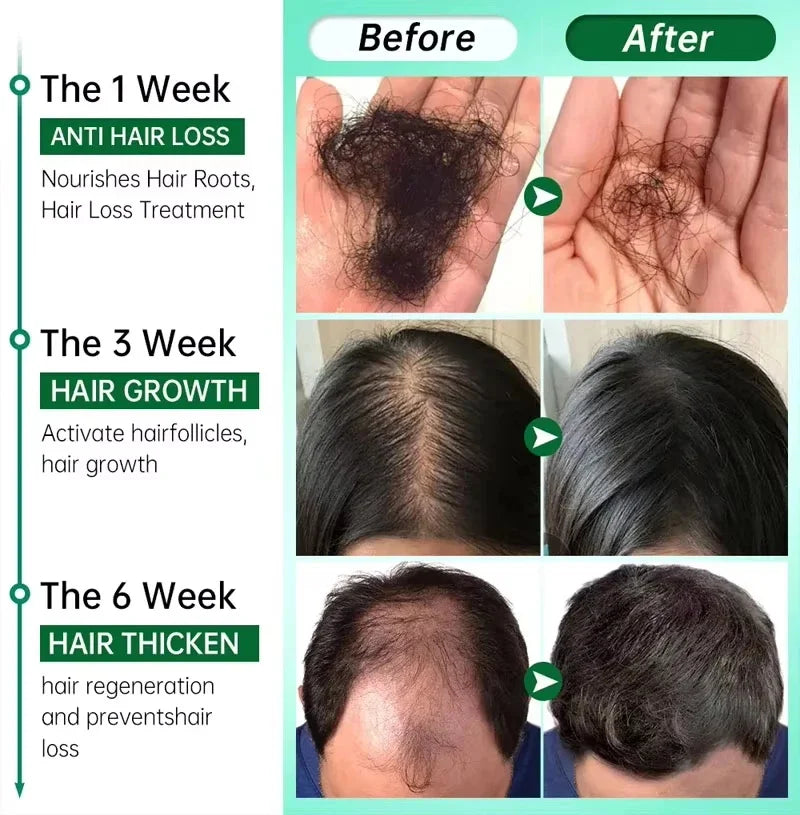 Ginger Hair Growth Serum 35ml for Men & Women