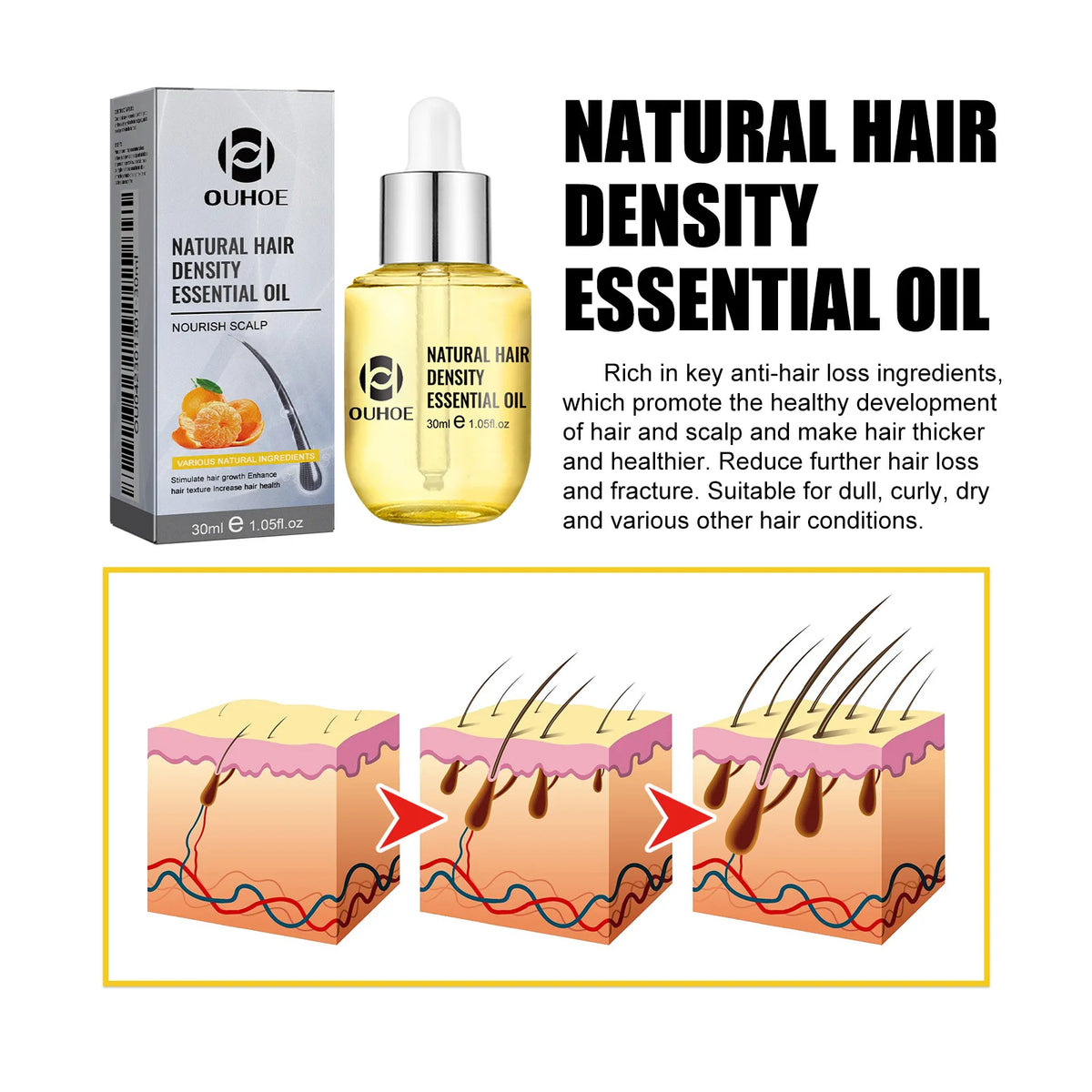 Hair Growth Essential Oil Treatment Seborrheic Alopecia Follicle Repairing Reduce Hairline Baldness Dense Growing Hairs Lotion - AliExpress 66