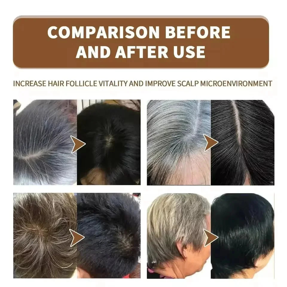 Gray to Black Hair Treatment Serum ¨C Natural Color Restore