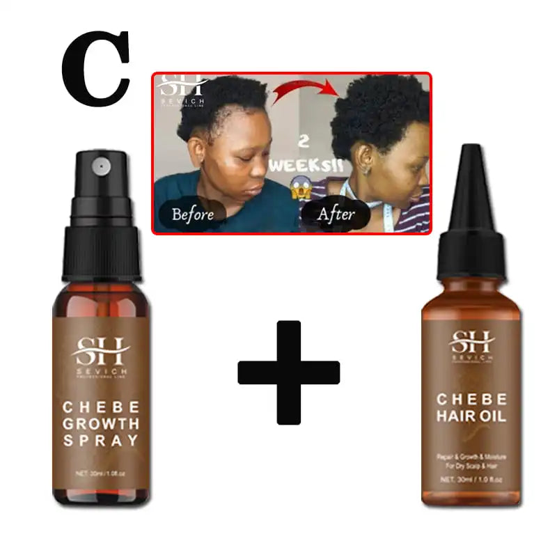 Sevich Chebe Powder for Hair Growth & Loss Prevention