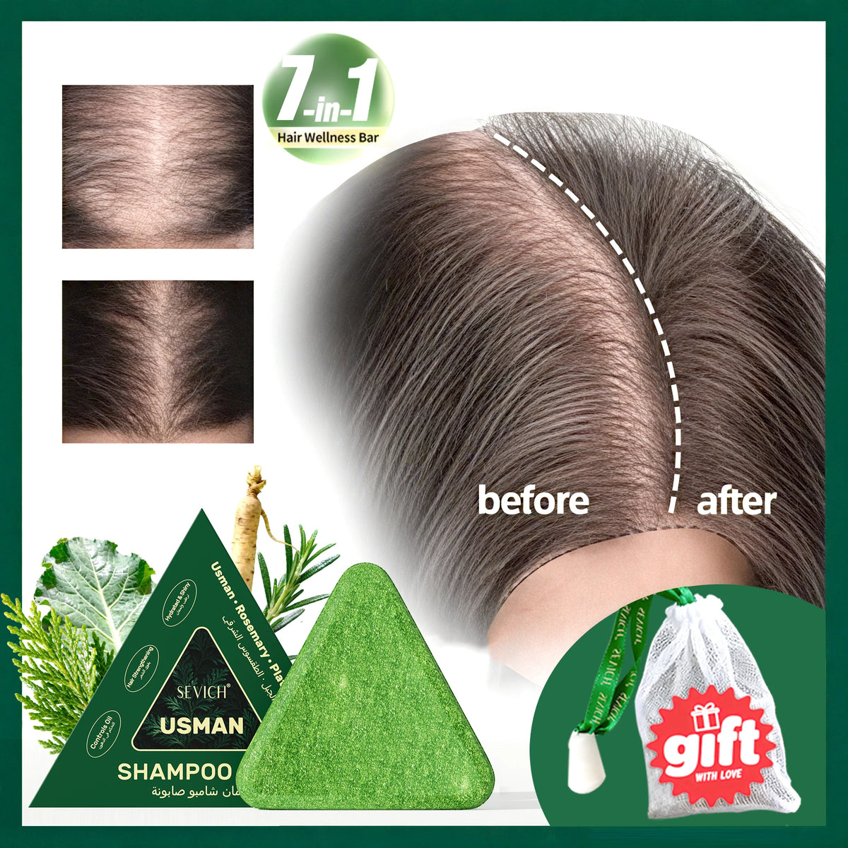 Anti Hair Loss Serum Set Hair Growth Essential Oil Usman Hair Regrowth Shampoo Soap Hair Care Thickening Oil Spray For Men Women - AliExpress 66