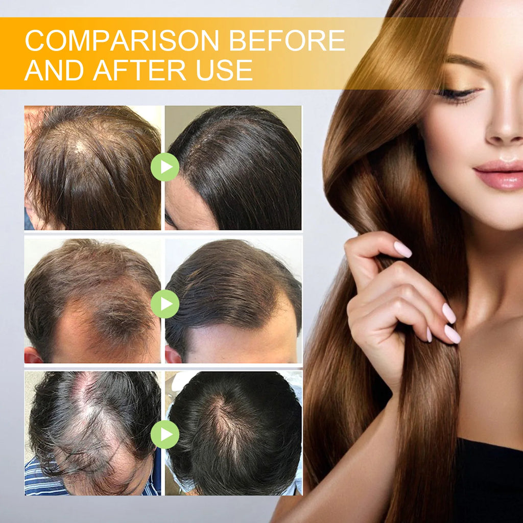 EELHOE Biotin Hair Spray For Man Women 30ml Hair Growth Repair Damage Restore Oil Scalp Repair Serum Spray Thicken Hair Care - AliExpress 66