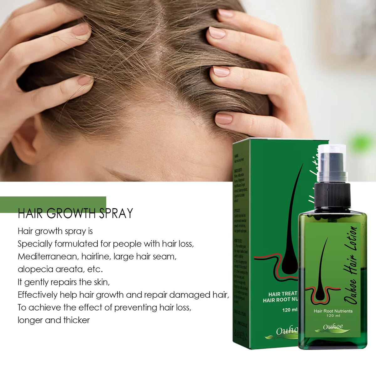 Hair Regrowth For Man Hair Growth Spray Anti Hair Loss Baldness Hair Root Repair Damaged Scalp Treatment Hair Growth Serum New - AliExpress 66