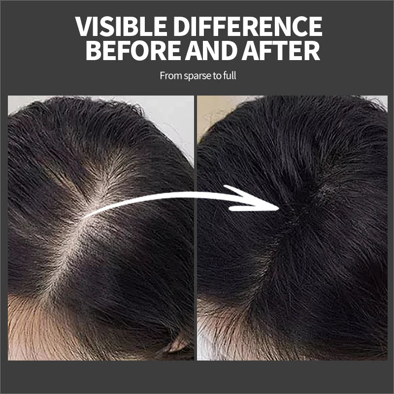 25g Hair Fibers Regrowth Powders Hair Building Fiber Natural Keratin Styling Powder Optimizer Dense Hair Care Regrowth Fiber - AliExpress 66