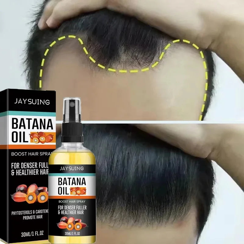 Batana Oil Hair Growth Serum Spray for Hair Regrowth