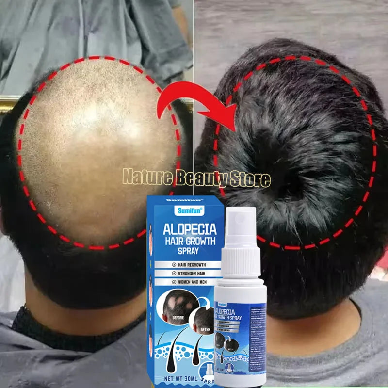 Fast Hair Growth Serum Spray Anti Hair Loss Prevent Baldness Scalp Treatment Repair Roots Beauty Health Hair Care For Men Women
